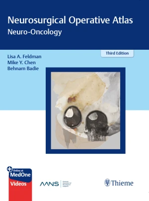 Neurosurgical Operative Atlas: Neuro-Oncology
